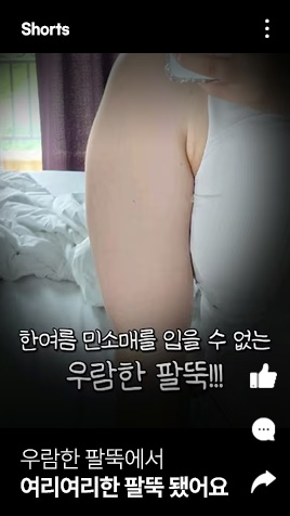 우람한 팔뚝에서 여리여리한 팔뚝 됐어요