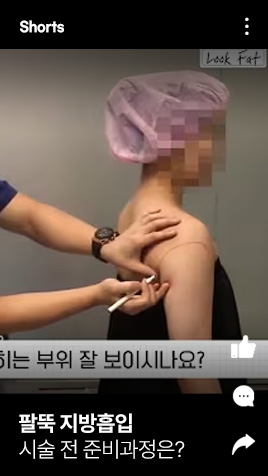 팔뚝 지방흡입 시술 전 준비과정은?