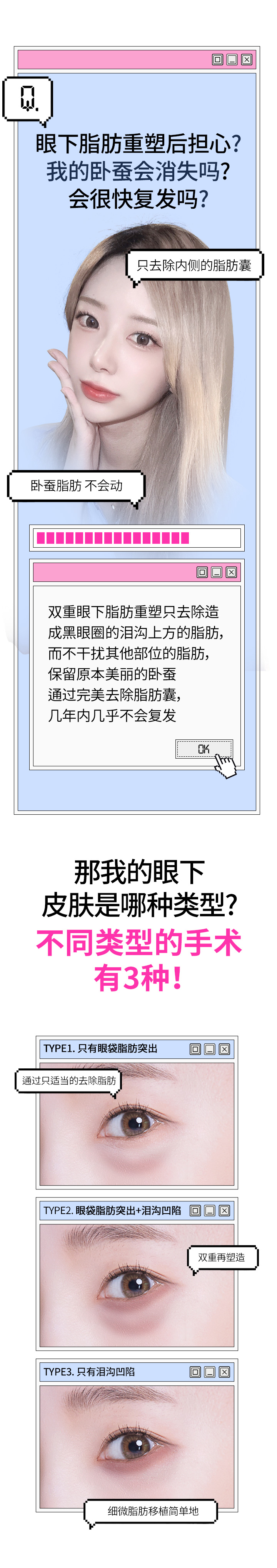 双重眼下脂肪重塑只去除造成黑眼圈的泪沟上方的脂肪, 而不干扰其他部位的脂肪, 保留原本美丽的卧蚕通过完美去除脂肪囊, 几年内几乎不会复发.