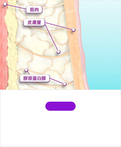 STEP 01 因皮肤老化而 沉积松弛的胶原蛋白