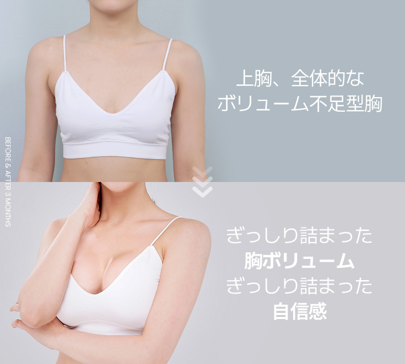 はっきりと変わった ボディーライン FAT-BRA