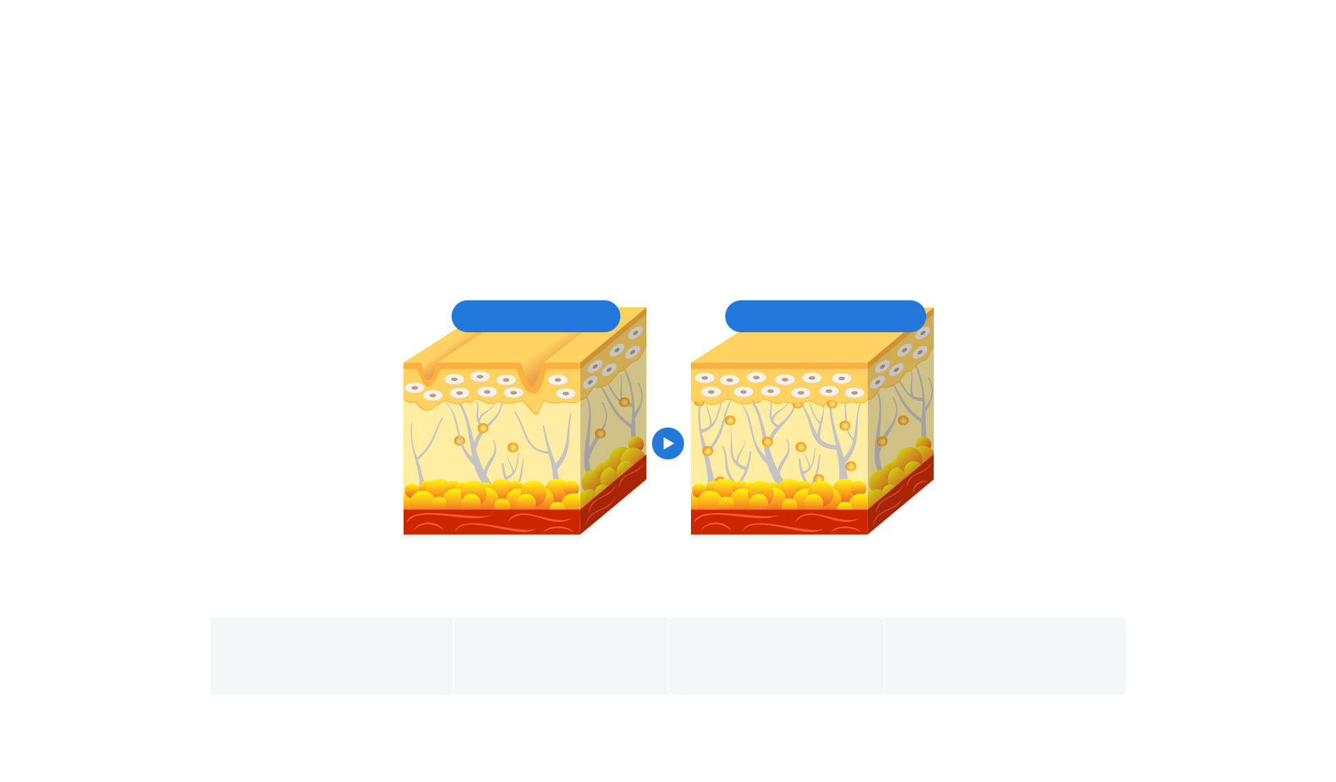 体内で分解される溶ける糸 PDO成分のブルーローズ糸は時間が経つにつれて 体内で自然に分解され、老廃物と一緒に排出されます。 また、体内で糸が溶ける過程で コラーゲンとエラスチンの再生を促進し、肌の弾力を高めます。