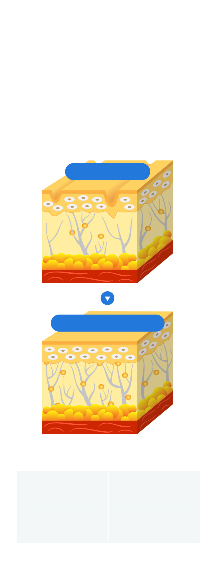 体内で分解される溶ける糸 PDO成分のブルーローズ糸は時間が経つにつれて 体内で自然に分解され、老廃物と一緒に排出されます。 また、体内で糸が溶ける過程で コラーゲンとエラスチンの再生を促進し、肌の弾力を高めます。