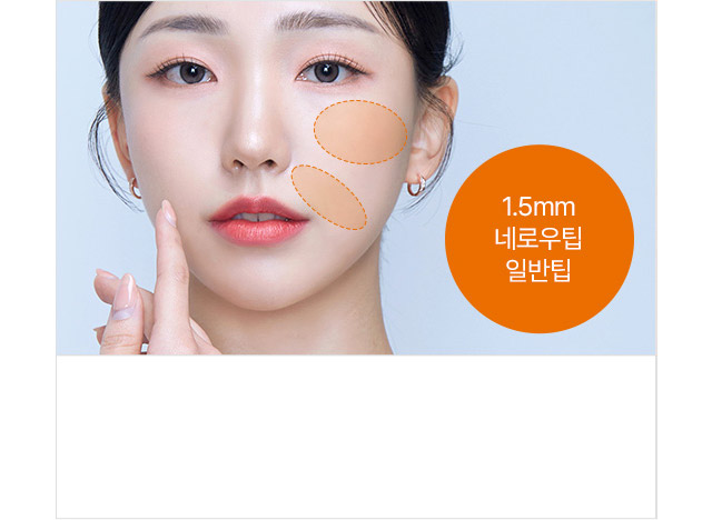 1.5mm 네로우팁 일반팁 콜라겐재생부위 : 팔자주름, 꺼진 앞광대