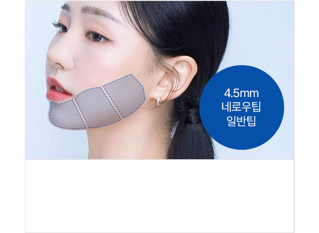 4.5mm 네로우팁 일반팁 근막층리프팅부위 : 탄력을 잃은 턱선, 얼굴 라인