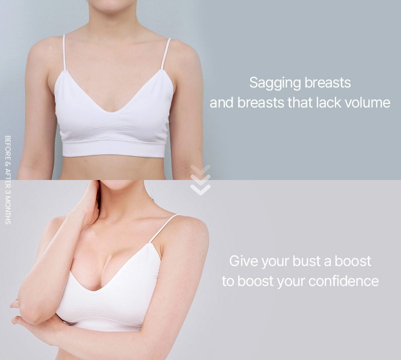 Sagging breasts and breasts that lack volume Give your bust a boost to boost your confidence 