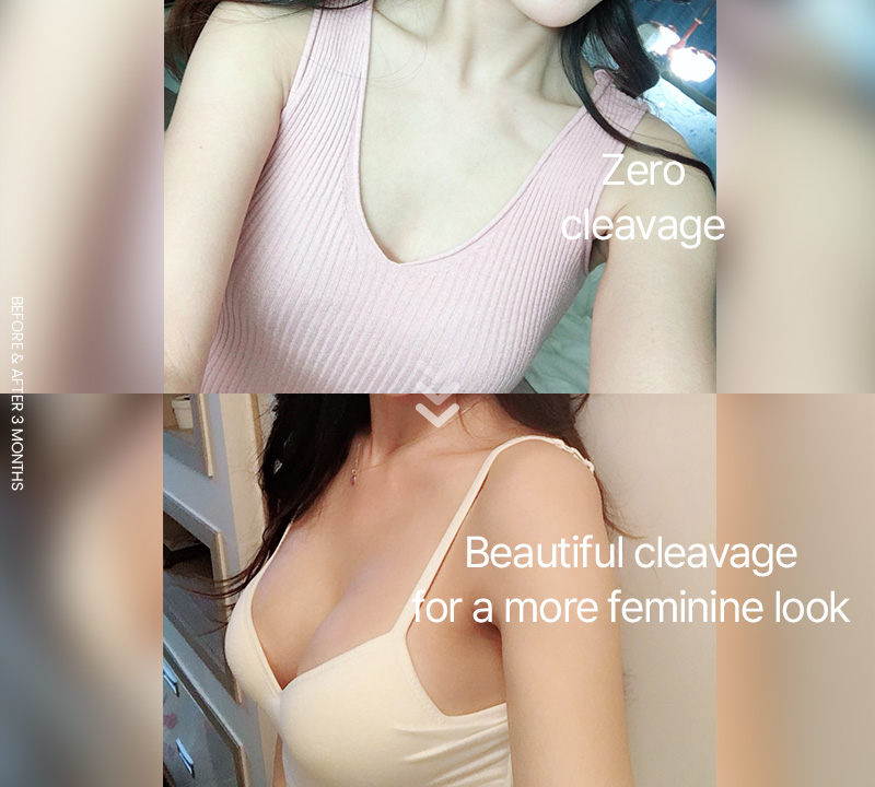 Zero cleavage