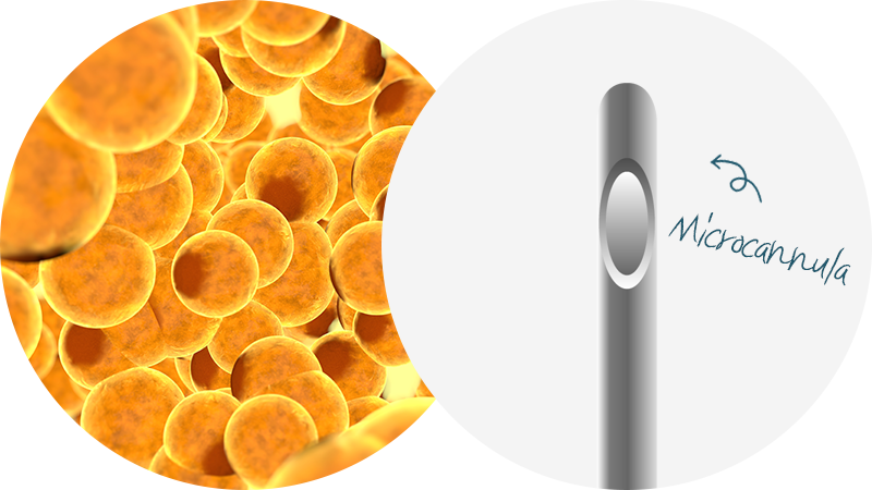 Injecting excessive fat into a single area can lead to poor engraftment. Say Yes injects fat meticulously and evenly to improve engraftment.