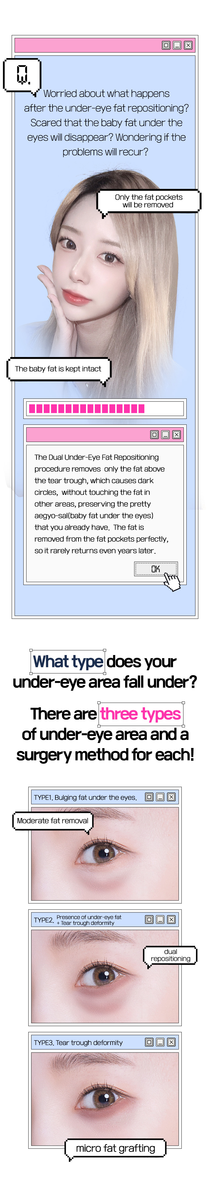 듀얼Under-eye Fat Repositioning는 다른 부위의 지방은 건드리지 않고 다크써클의 원인이 되는 눈물 고랑 위쪽의 지방만 제거하여 내가 가지고 있는 예쁜 애교살은 보존합니다. 완벽한 지방주머니의 지방제거로 몇 년이 지나도 재발하는 일은 거의 없습니다.