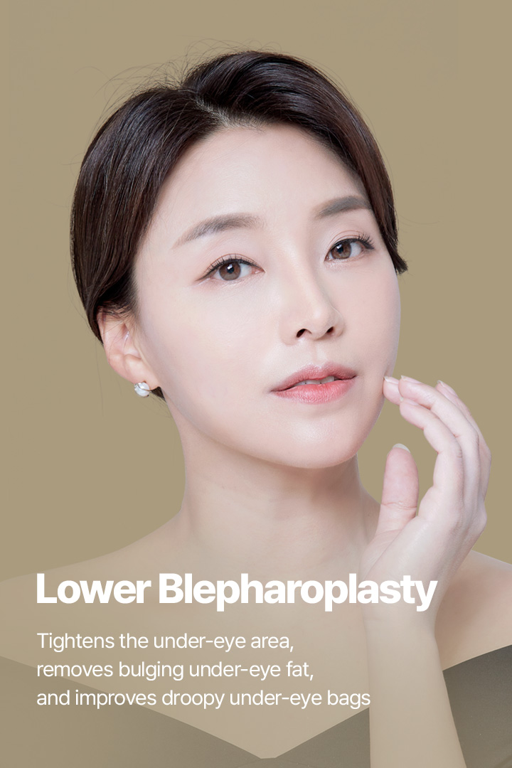 Lower Blepharoplasty Tightens the under-eye area, removes bulging under-eye fat, and improves droopy under-eye bags