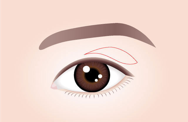 STEP 01 Design We devise a surgery plan and design the upper eyelids according to the individual's aging condition and the degree of skin sagging.