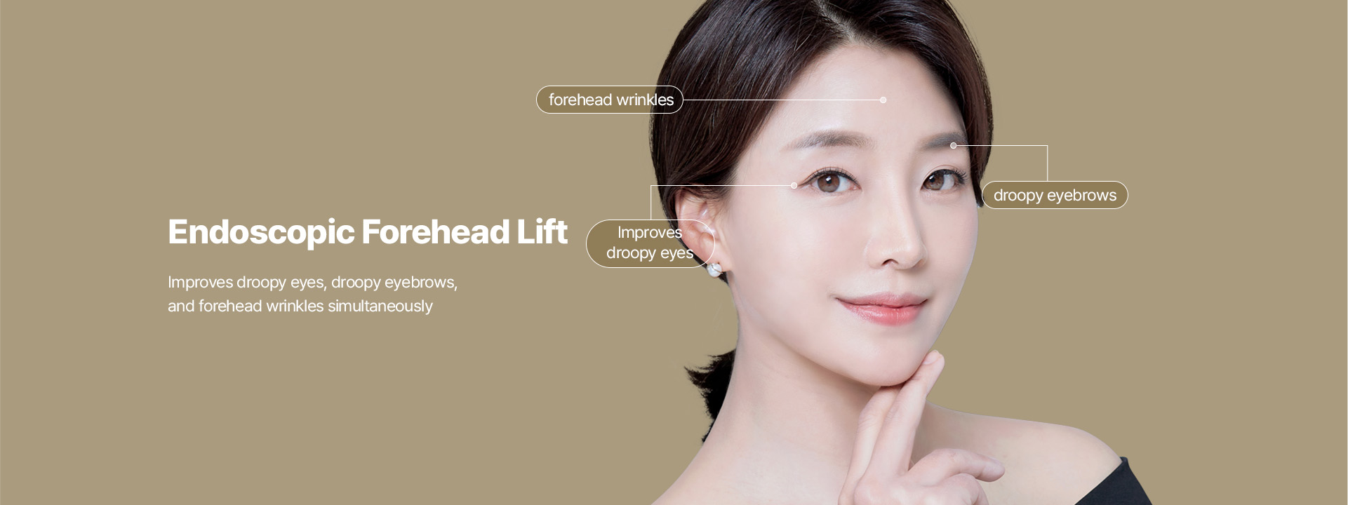 Endoscopic Forehead Lift Improves droopy eyes, droopy eyebrows, and forehead wrinkles simultaneously