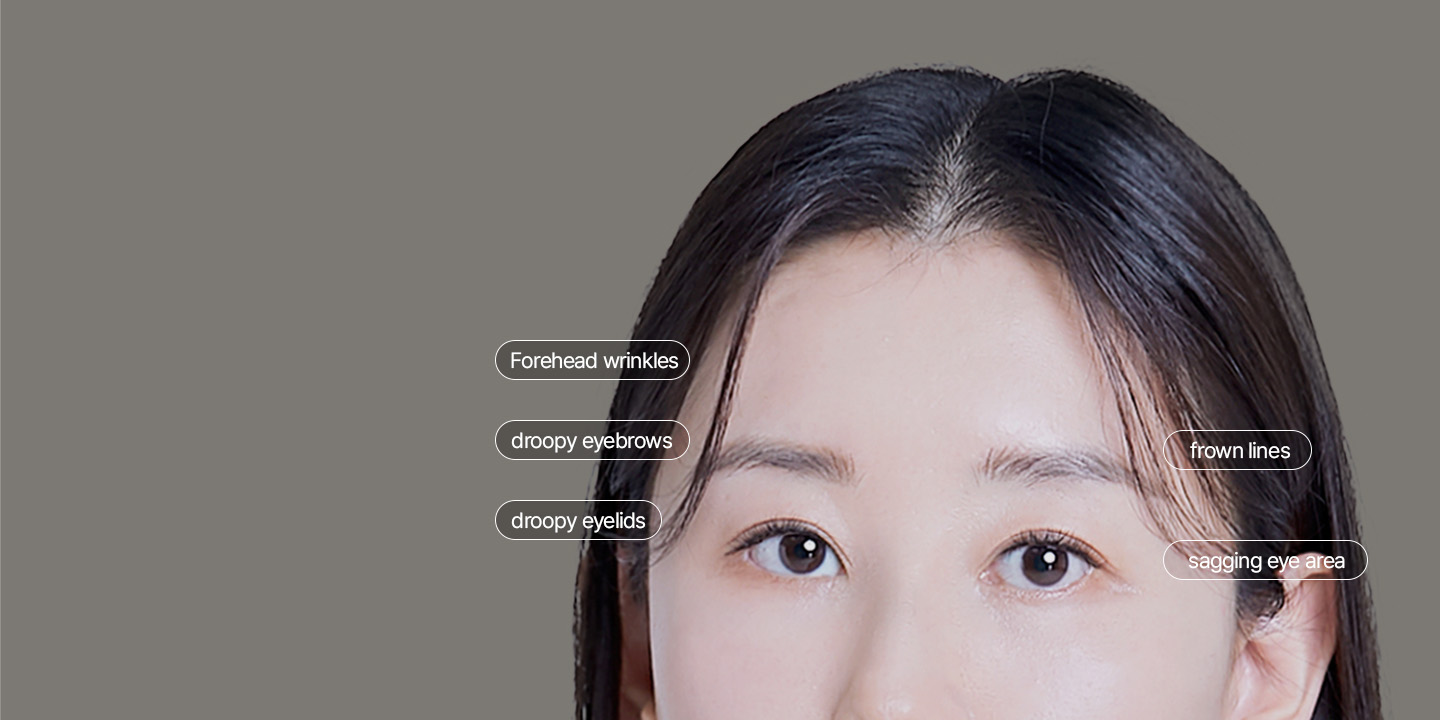 Depressed look and signs of aging + Droopy eyes + Droopy eyebrows + Frown lines + Forehead wrinkles The problems can be addressed all at once with Endoscopic Forehead Lift