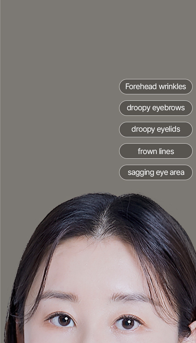 Depressed look and signs of aging + Droopy eyes + Droopy eyebrows + Frown lines + Forehead wrinkles The problems can be addressed all at once with Endoscopic Forehead Lift