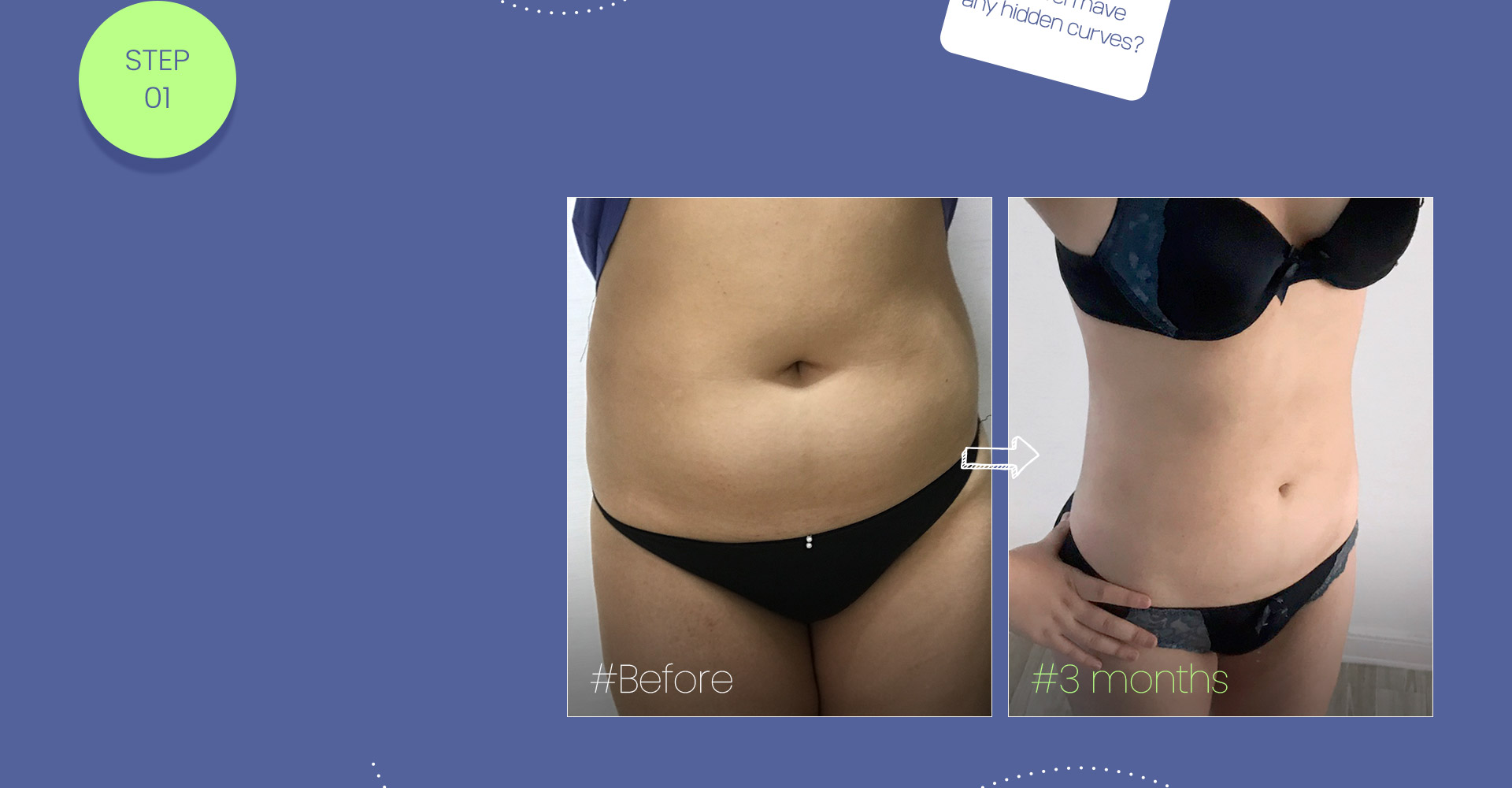 #Large-volume liposuction #Boost your confidence with a smaller waist #Reduce your waist size by more than 3 inches! #Fast recovery and immediate results!