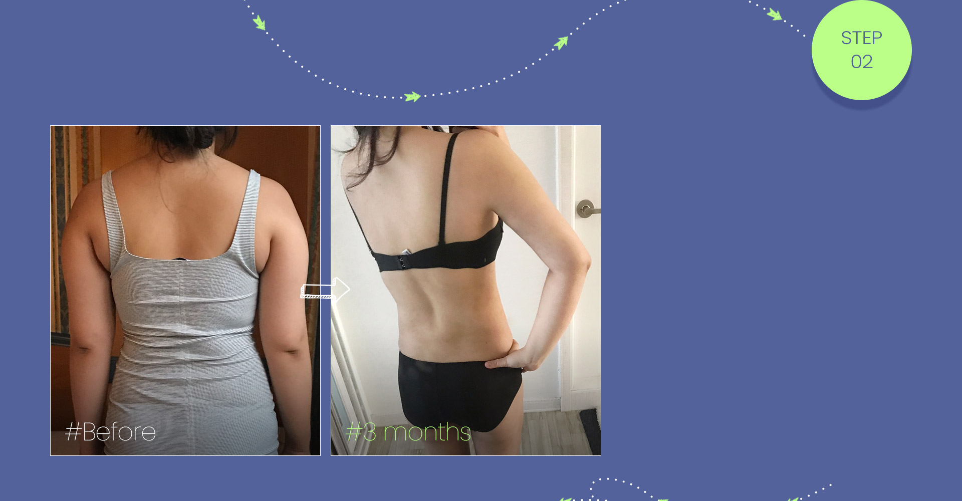 #The key to full-body liposuction is the overall balance  The back must also be without any excess fat for effective liposuction #Remove 2,000cc of fat from the arms, the most exposed part of the body, to contour the upper body!