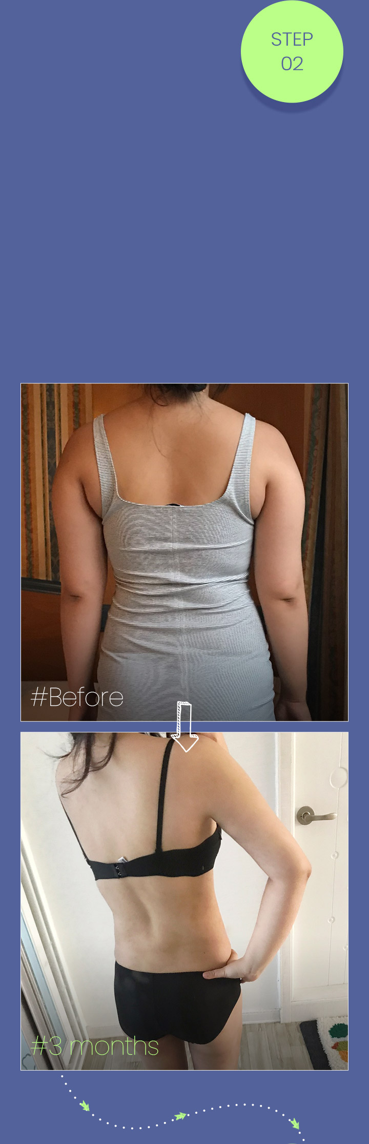 #The key to full-body liposuction is the overall balance  The back must also be without any excess fat for effective liposuction #Remove 2,000cc of fat from the arms, the most exposed part of the body, to contour the upper body!