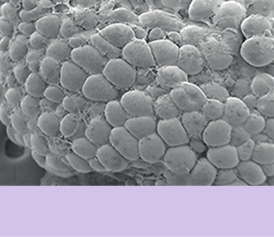 Fat cells that received just RF energy