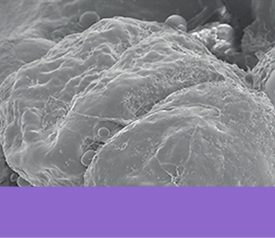 Fat cells that received RF energy + HVP