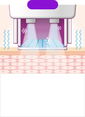 STEP 02 The cooling system is activated and auto-tuning begins as soon as treatment begins