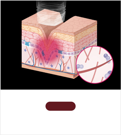 STEP 01 Tissue aggregation