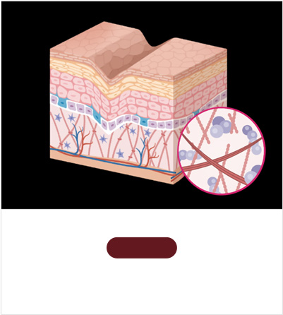 STEP 02 Recovery of aggregated tissue