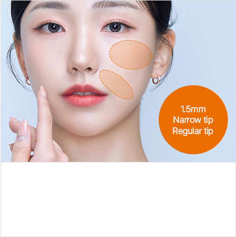 1.5mm Narrow tip Regular tip Collagen regenerationSites : Nasolabial folds, sunken front cheekbone area