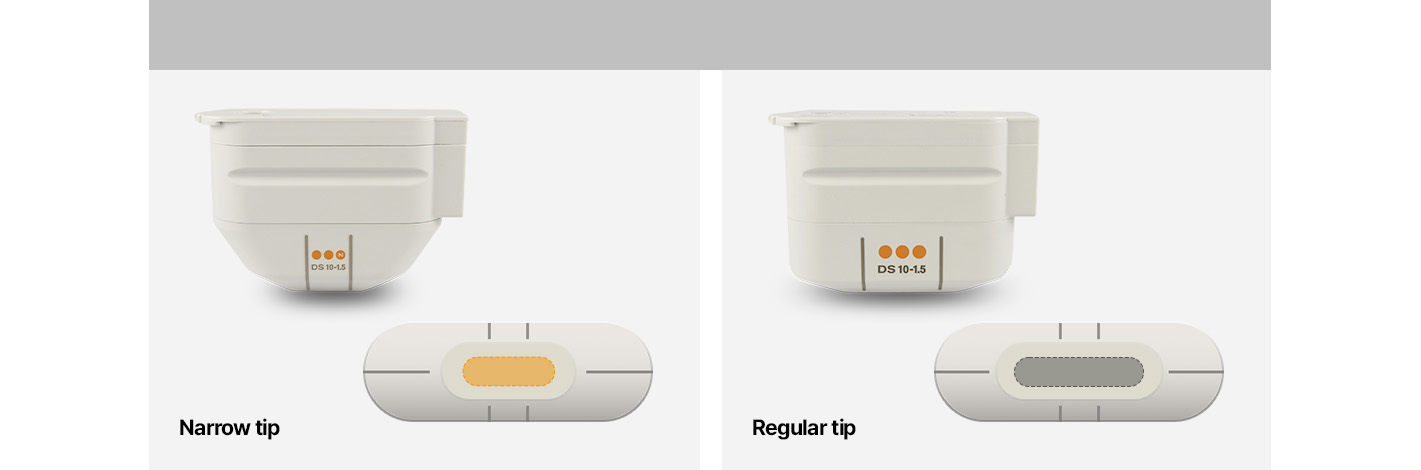 Comparison of the area coverage between the narrow tip and regular tip