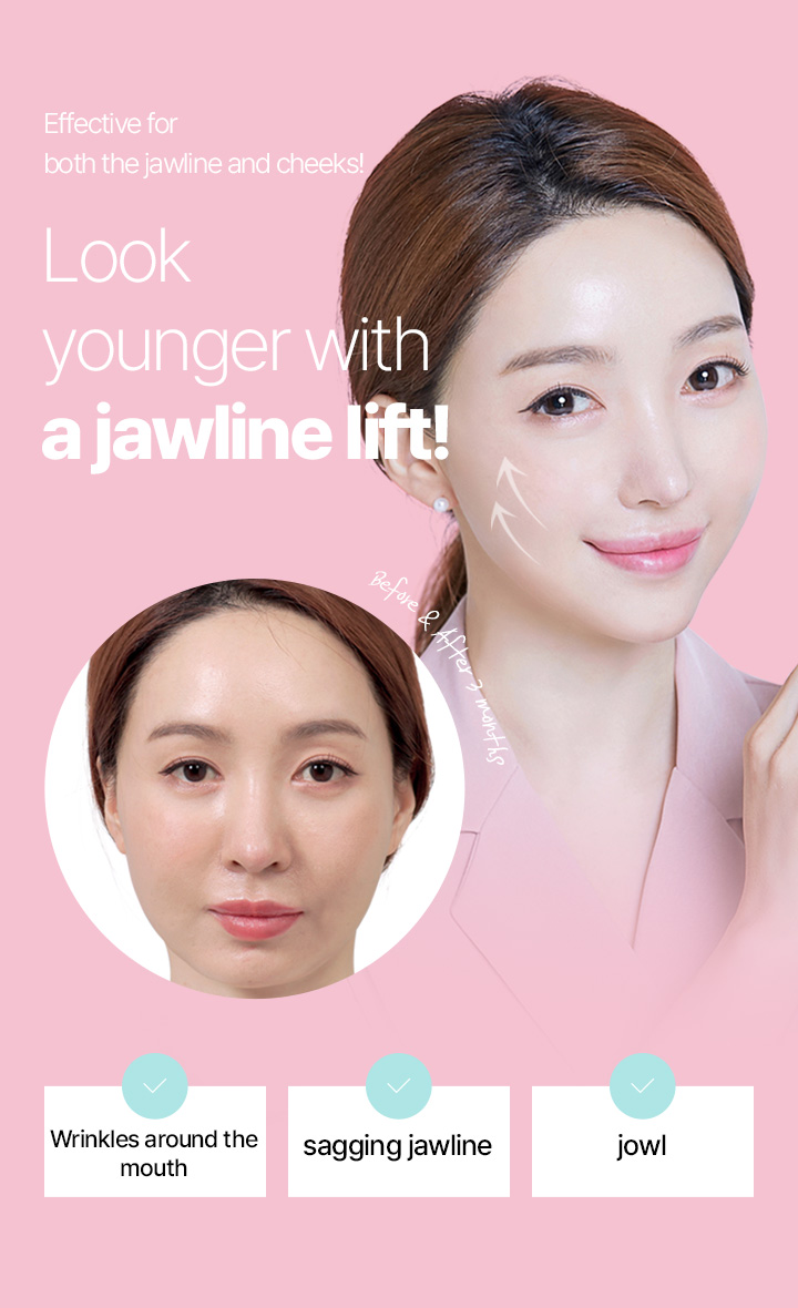 Effective for both the jawline and cheeks!  Look younger with a jawline lift