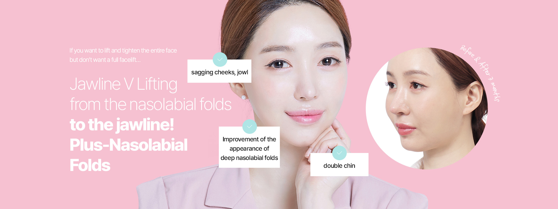 If you want to lift and tighten the entire face but don’t want a full facelift! Jawline V Lifting from the nasolabial folds to the jawline! Plus-Nasolabial Folds