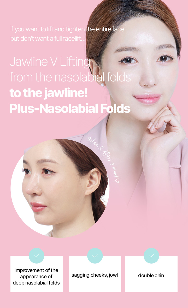 If you want to lift and tighten the entire face but don’t want a full facelift! Jawline V Lifting from the nasolabial folds to the jawline! Plus-Nasolabial Folds