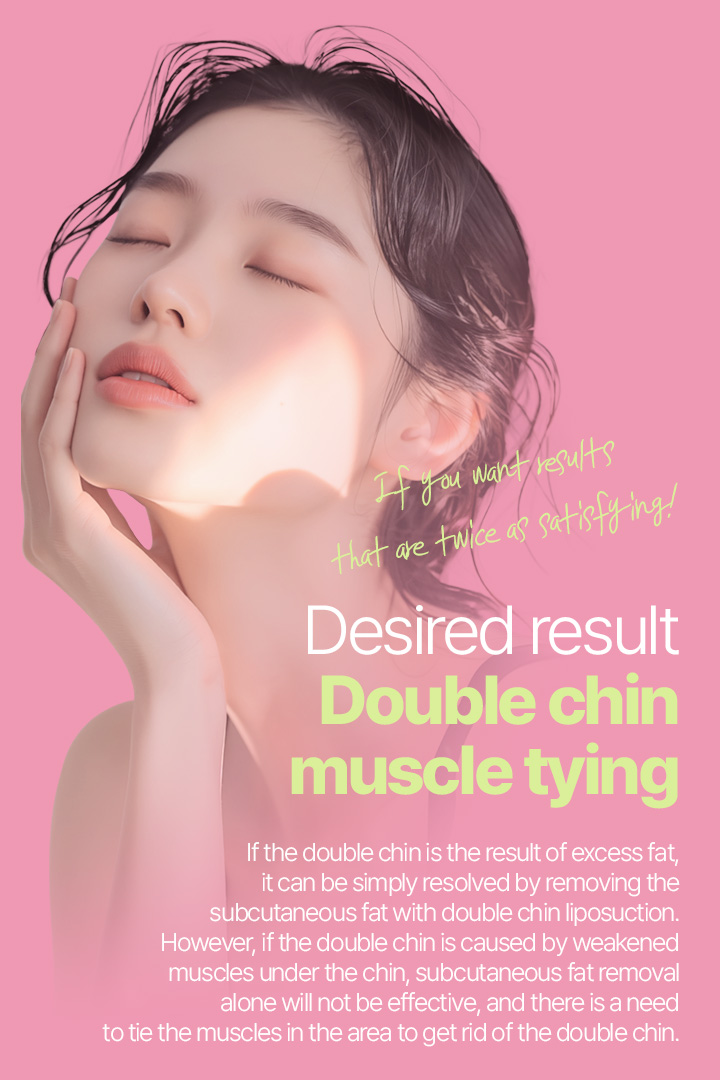 If you want results that are twice as satisfying! Desired result Double chin muscle tying  If the double chin is the result of excess fat, it can be simply resolved by removing the subcutaneous fat with double chin liposuction. However, if the double chin is caused by weakened muscles under the chin, subcutaneous fat removal alone will not be effective, and there is a need to tie the muscles in the area to get rid of the double chin.