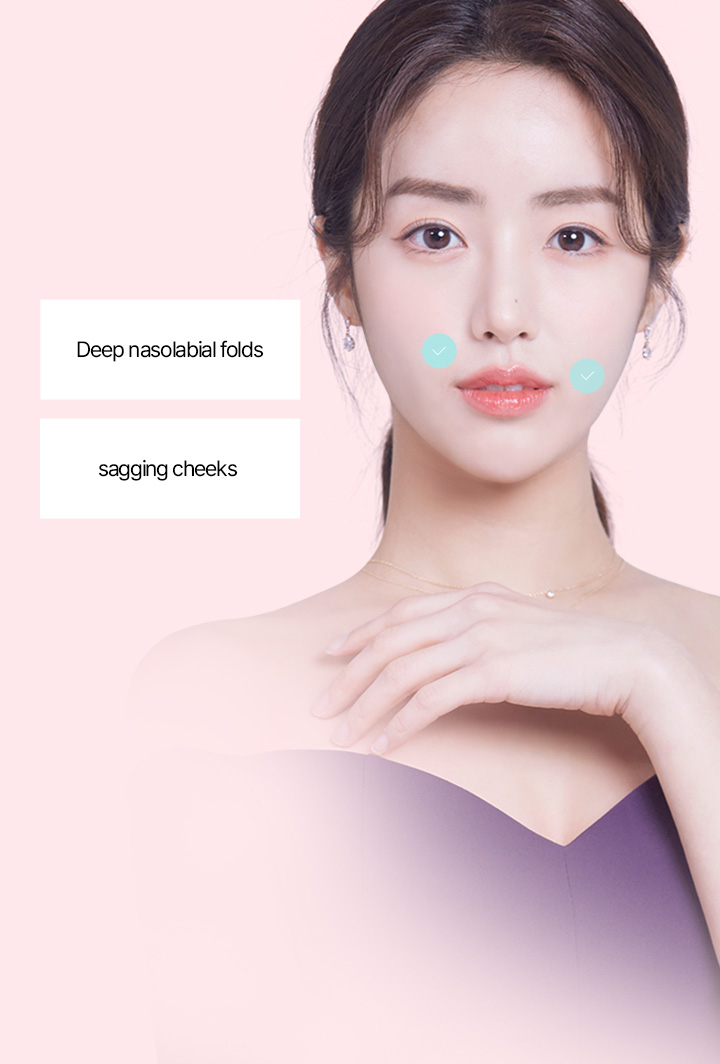 It is recommended for 1 those who don’t want to undergo a facelift  2 those who are concerned about the signs of aging in the cheek area, mouth area, and jawline 3 those who want to look more youthful 4 those who have not seen any noticeable results with laser or thread lift procedures