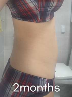 LookFat, extraction of pure fat b&a photo