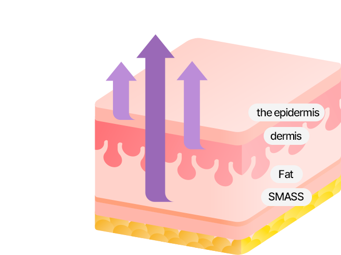 Lifting that simply  pulls up the skin? No! SAYYES 4X Mini Lifting pulls up the epidermis, dermis, SMASS, and retaining ligaments and lifts the sagging skin from the inside for a maximum effect!