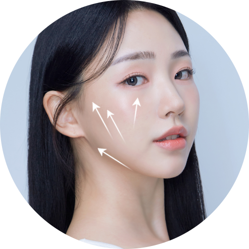 4X Mini Lifting for a Vertical Lift! The conventional lateral lifting procedures had downsides such as highlighting the cheekbones and making the face appear wider. In contrast, SAYYES 4X Mini Lifting fixes the skin vertically and obliquely for a slimmer face and jawline (V line).