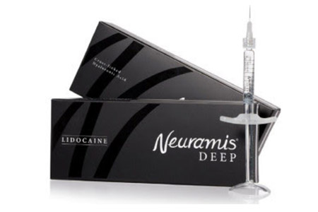 Neuramis Lidocaine A long-lasting domestic filler that contains lidocaine, a local anesthetic approved by the US FDA and Korean Ministry of Food and Drug Safety, for reduced pain