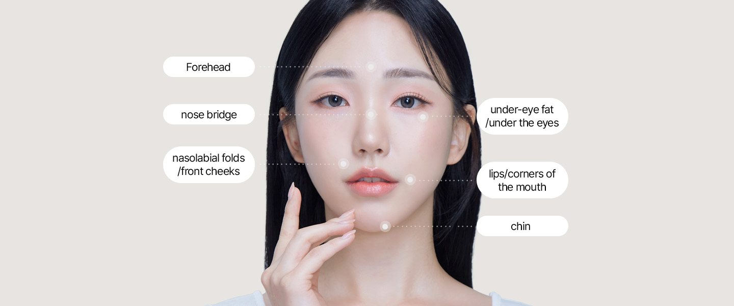 Filler Treatment Areas at SAYYES Forehead, nose bridge, nasolabial folds/front cheeks, under-eye fat/under the eyes, lips/corners of the mouth, chin