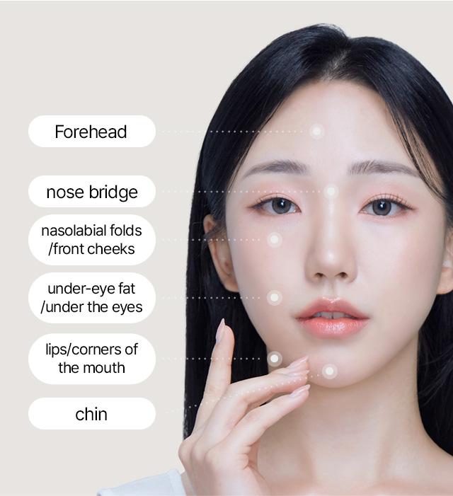 Filler Treatment Areas at SAYYES Forehead, nose bridge, nasolabial folds/front cheeks, under-eye fat/under the eyes, lips/corners of the mouth, chin