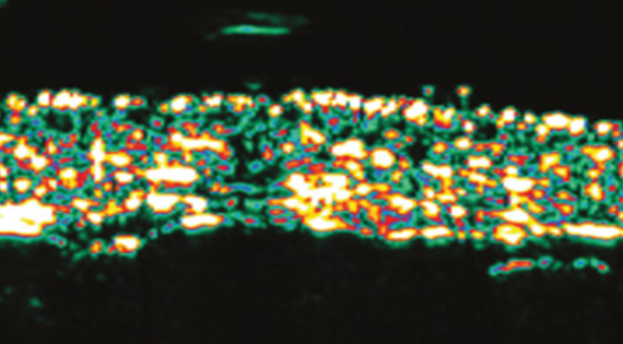 Skin tissue after the procedure