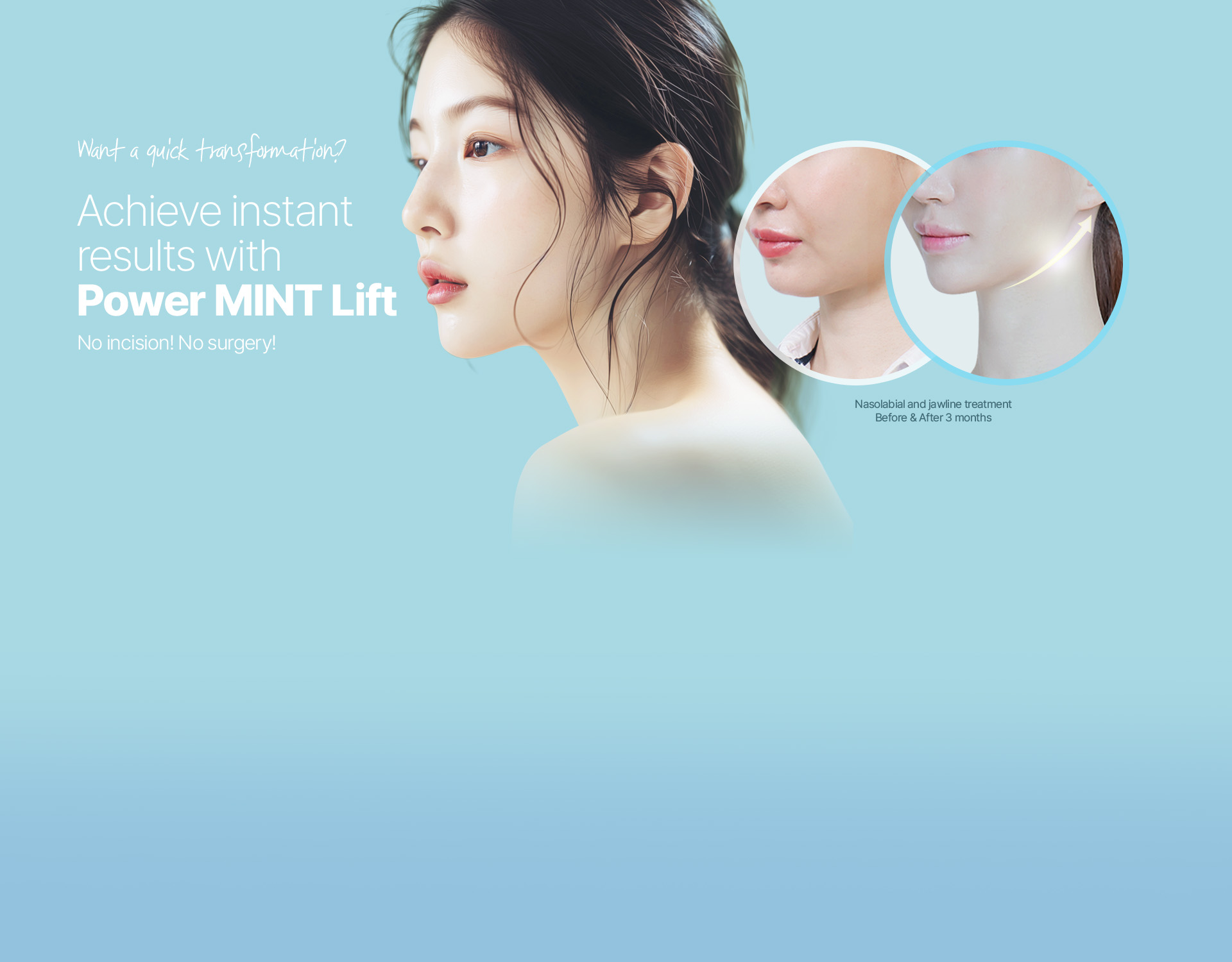 Want to achieve the effect of a facelift with a simpler procedure? Strong fixation and longer retention period than regular threads, Power MINT Lift